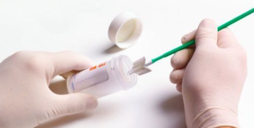 În Programul Naţional de depistare a cancerului de col uterin va fi introdusă şi o componentă mobilă