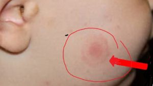 Vine sezonul căpușelor! Conf.univ.dr. Tudor Ciuhodaru, medic primar urgențe, cu Mihai Florin Pohoață, la ”Pulsul Zilei” – 21.04 2026.