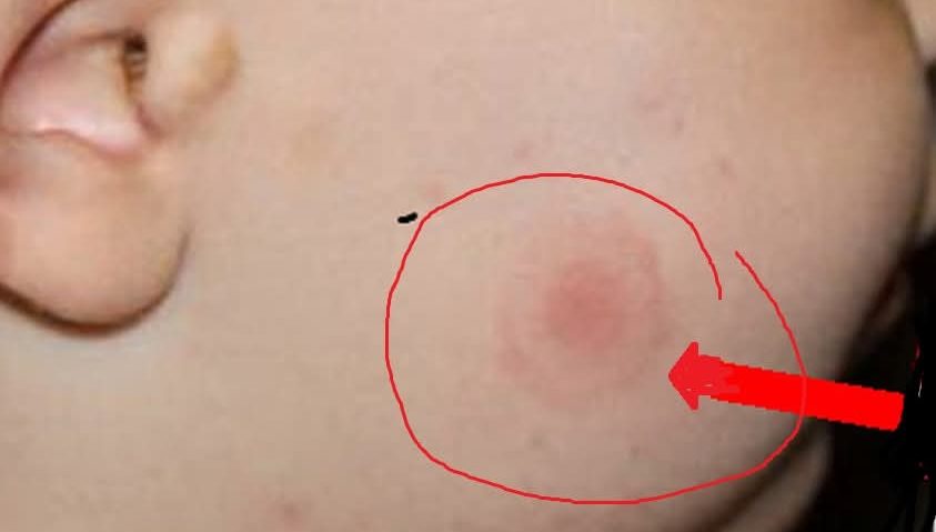 Vine sezonul căpușelor! Conf.univ.dr. Tudor Ciuhodaru, medic primar urgențe, cu Mihai Florin Pohoață, la ”Pulsul Zilei” – 21.04 2026.